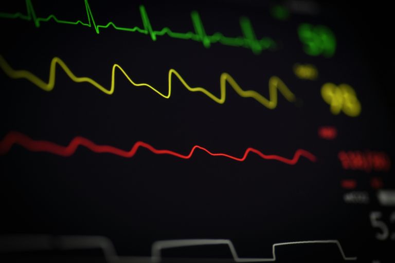 A cardiologist reviewing an AI-generated ECG analysis on a digital screen while examining a patient's heart health.