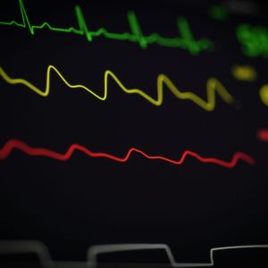 A cardiologist reviewing an AI-generated ECG analysis on a digital screen while examining a patient's heart health.