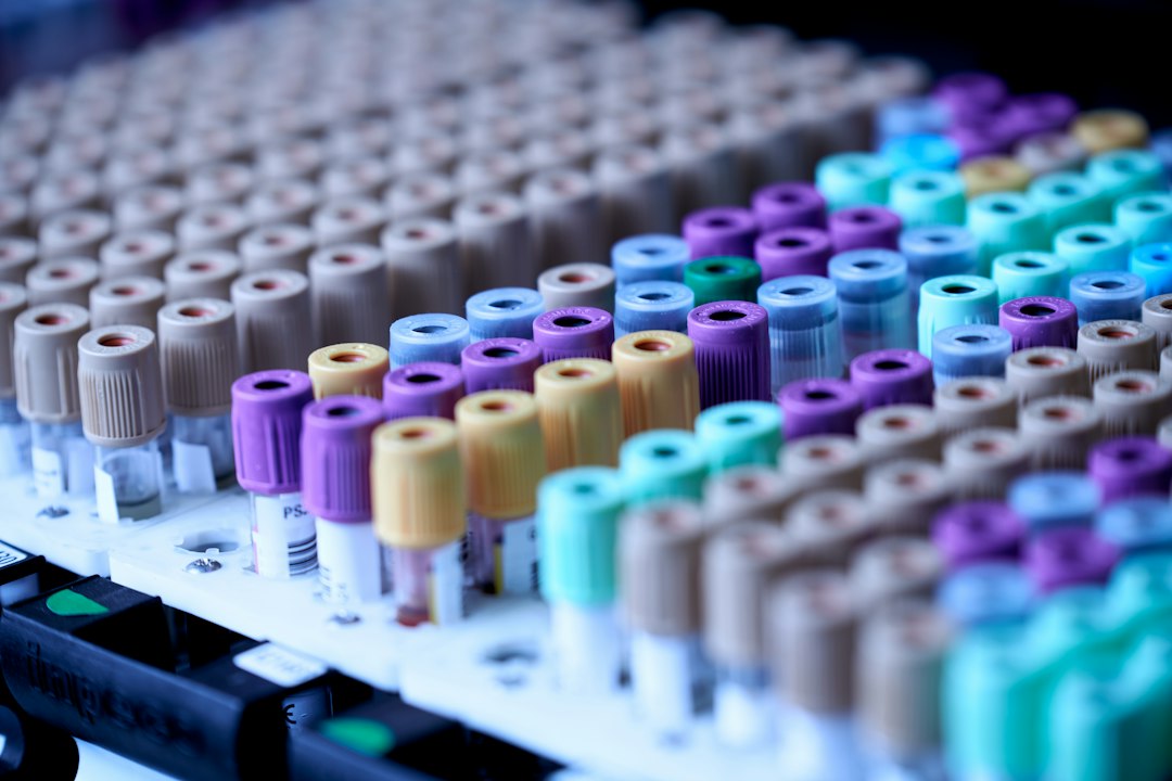 Blood Antibodies May Signal Inflammatory Bowel Disease a Decade Before Diagnosis